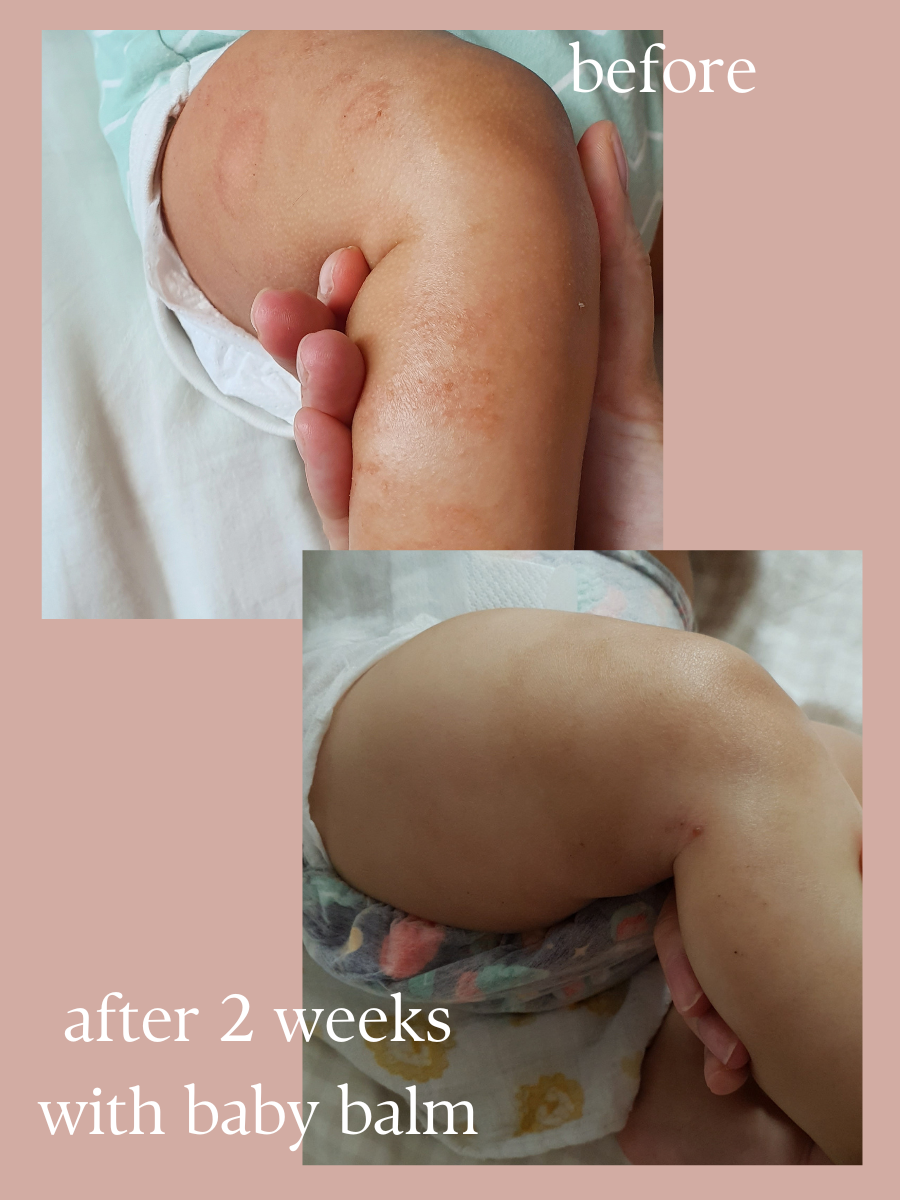 Multi Purpose Baby Balm Stick