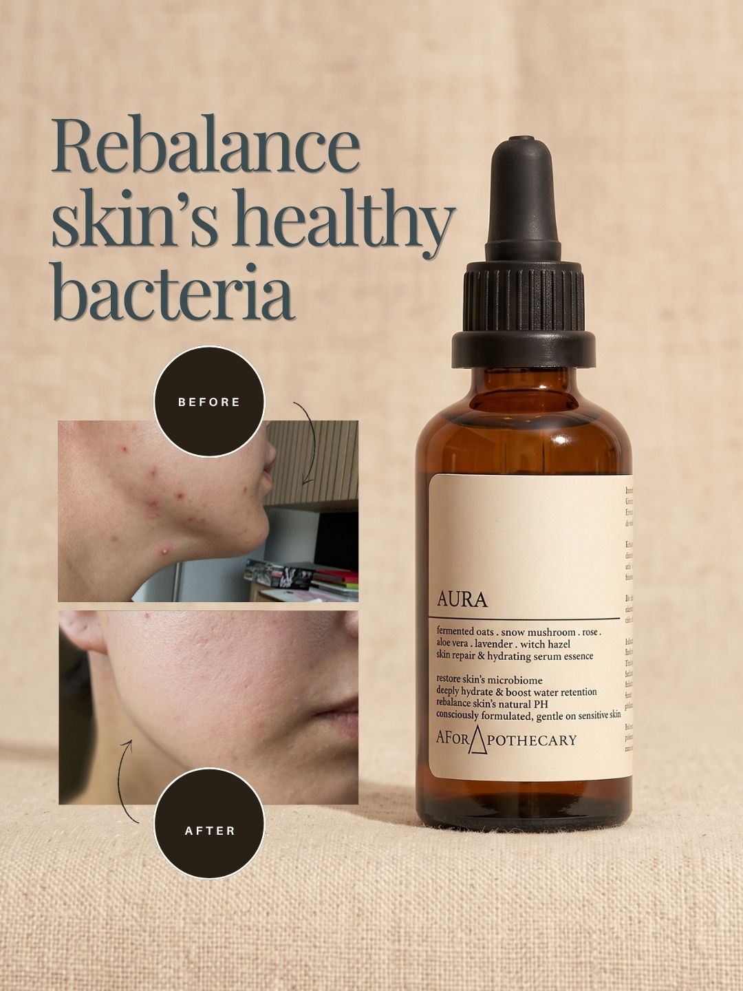 Aura Skin Reset Concentrate