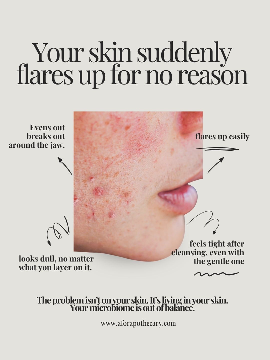 Aura Skin Reset Concentrate