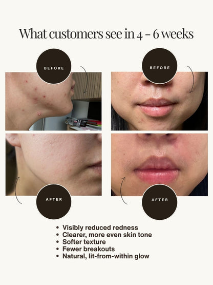 Aura Skin Reset Concentrate