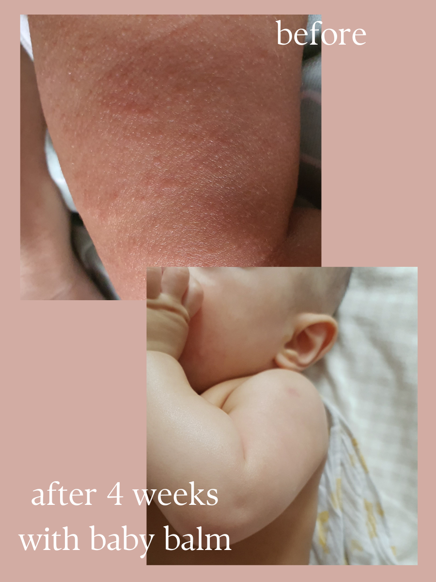 Multi Purpose Baby Balm Stick