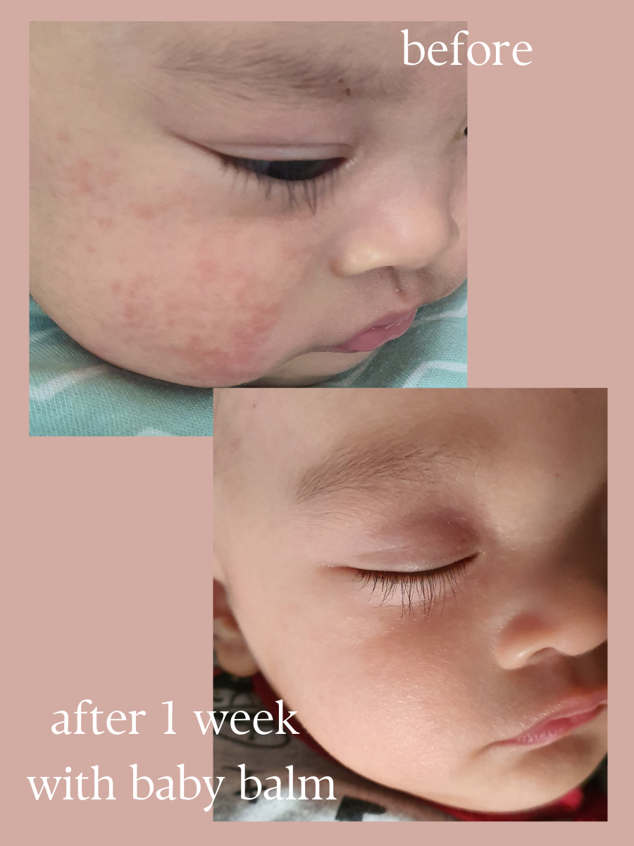Multi Purpose Baby Balm Stick